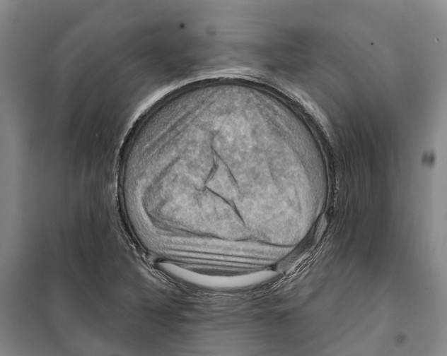 X0000099381316200806051112