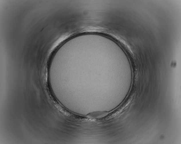 X0000099381317200806051112