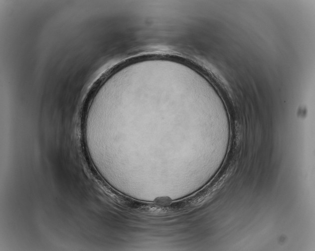 X0000099381318200806051112