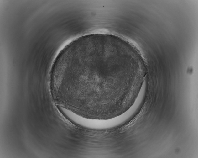 X0000099381326200806051112