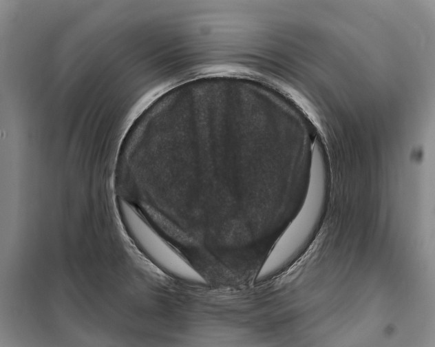 X0000099381330200806051112