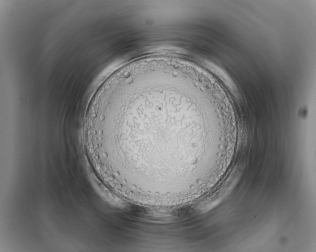 X0000099381338200806051112