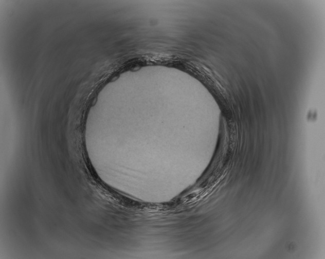 X0000099381345200806051111