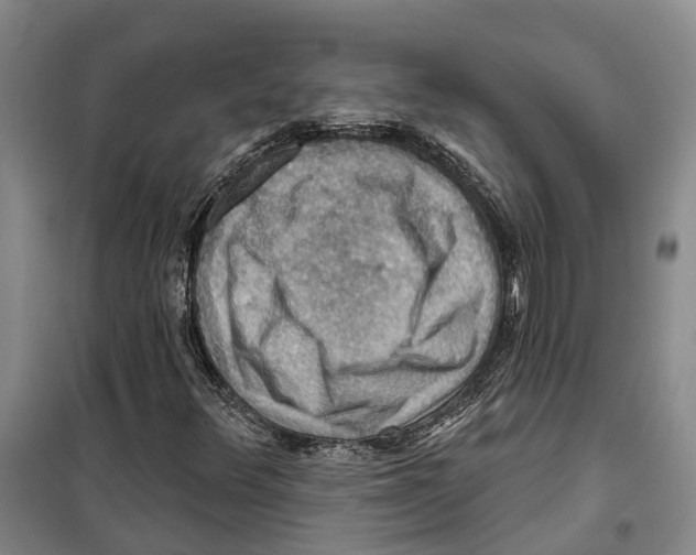 X0000099381348200806051111