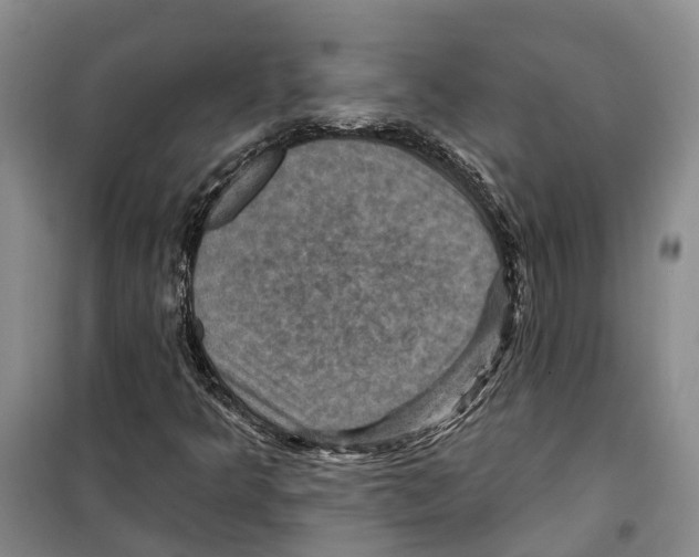 X0000099381349200806051111