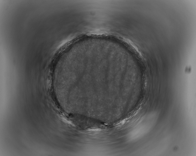X0000099381350200806051111