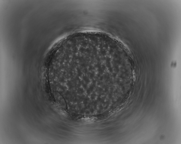 X0000099381351200806051111