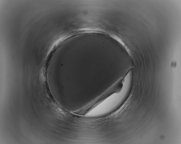 X0000099381357200806051111