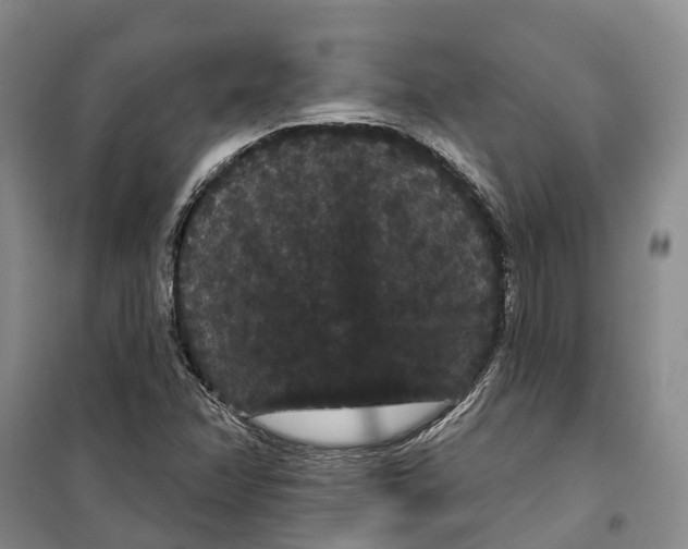 X0000099381358200806051111