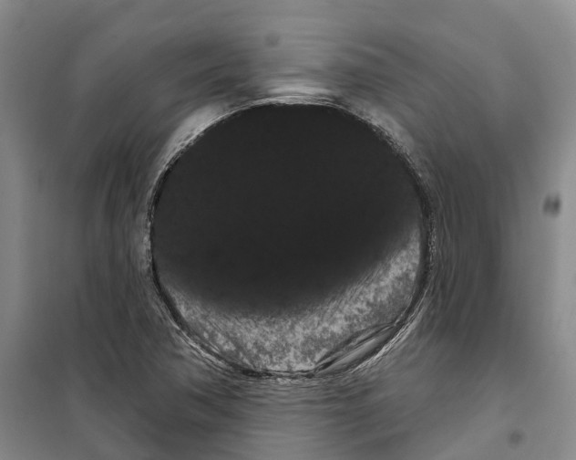 X0000099381362200806051111