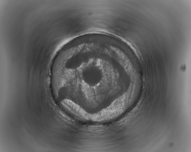 X0000099381363200806051111