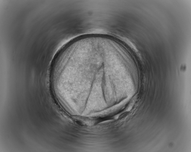 X0000099381364200806051111