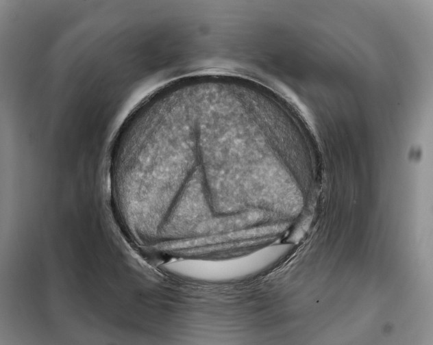X0000099381368200806051111