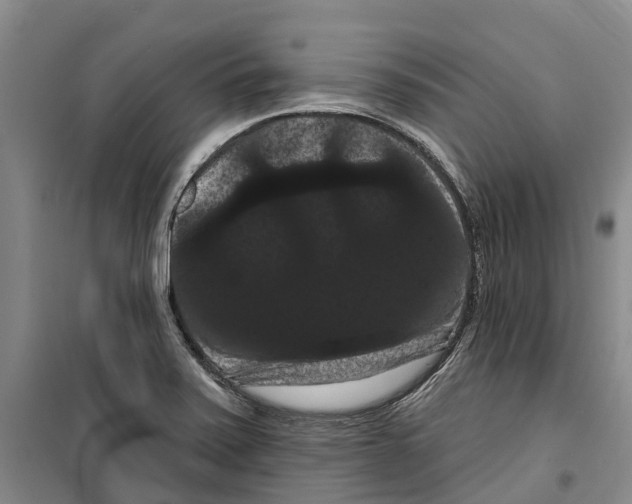 X0000099381371200806051111
