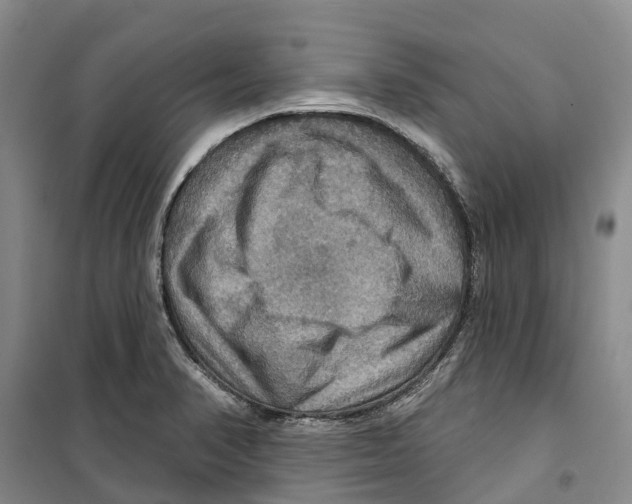 X0000099381374200806051111
