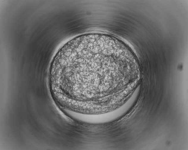 X0000099381379200806051111