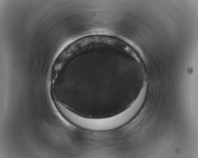 X0000099381383200806051111