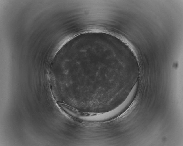 X0000099381385200806051111