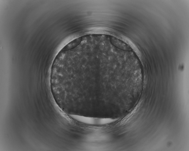 X0000099381386200806051111