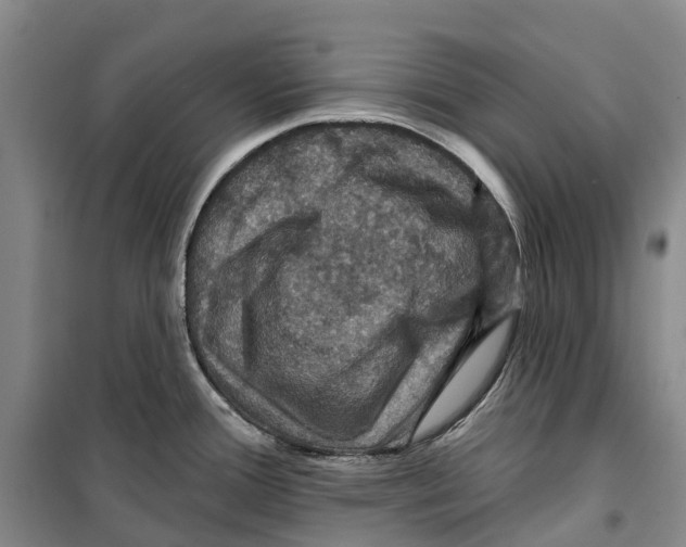 X0000099381388200806051111