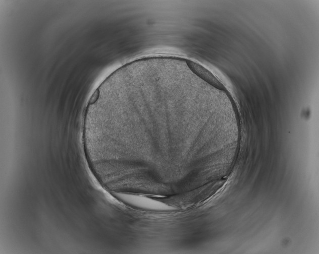X0000099381390200806051111