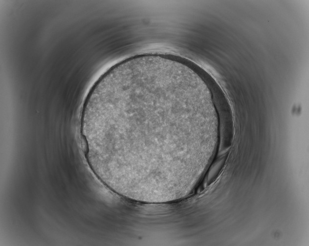 X0000099381392200806051111