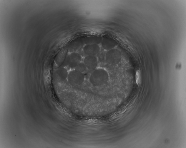 X0000099381395200806051110