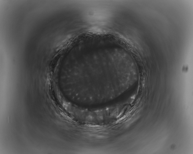 X0000099381397200806051110