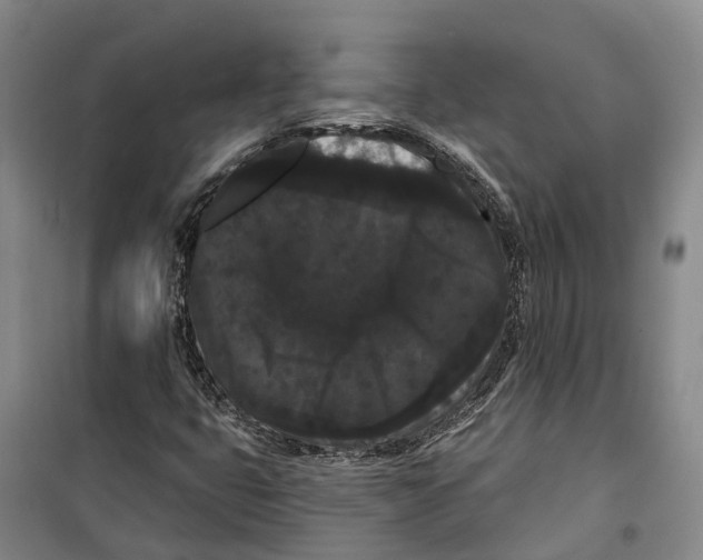 X0000099381399200806051110