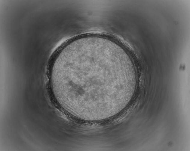 X0000099381400200806051110