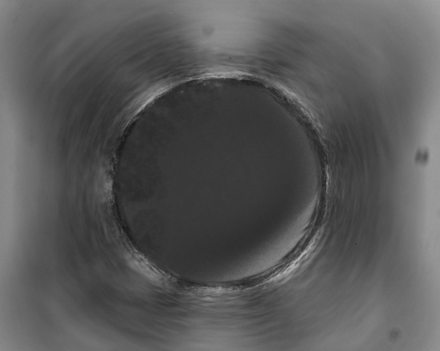 X0000099381401200806051110