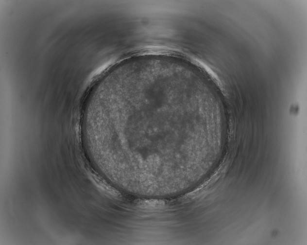 X0000099381403200806051110