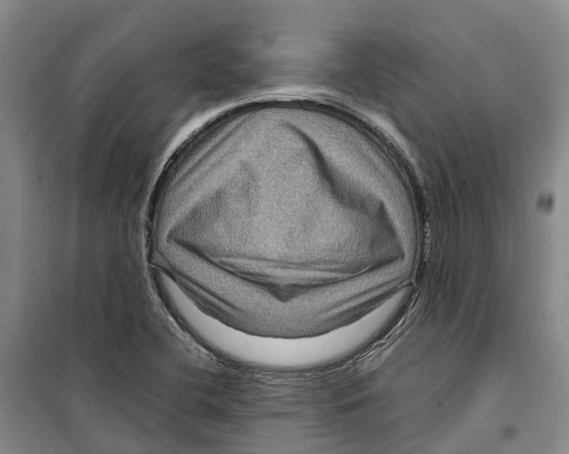 X0000099381412200806051110