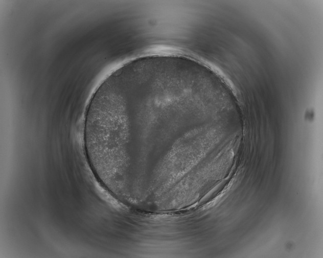 X0000099381421200806051110