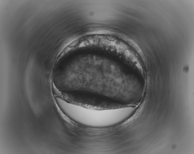 X0000099381425200806051110