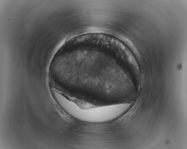X0000099381427200806051110