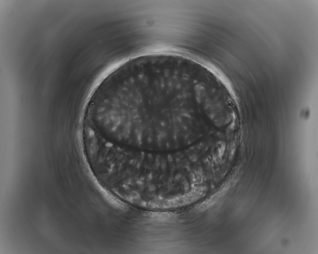 X0000099381429200806051110