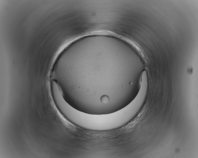 X0000099381430200806051110