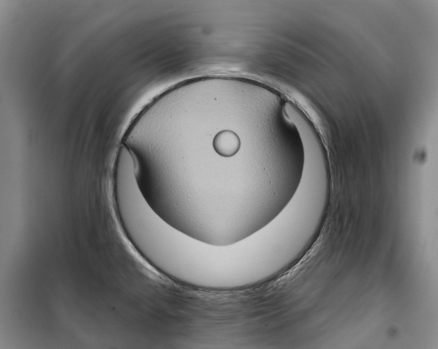 X0000099381432200806051110