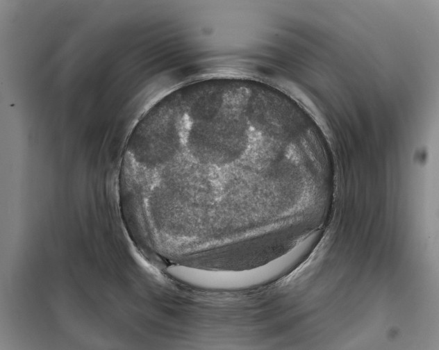 X0000099381433200806051111