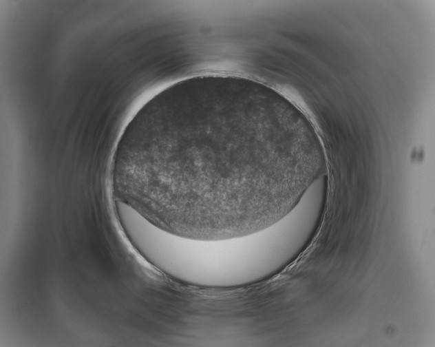 X0000099381440200806051111