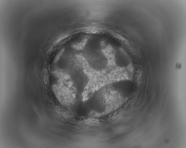 X0000099381446200806051110