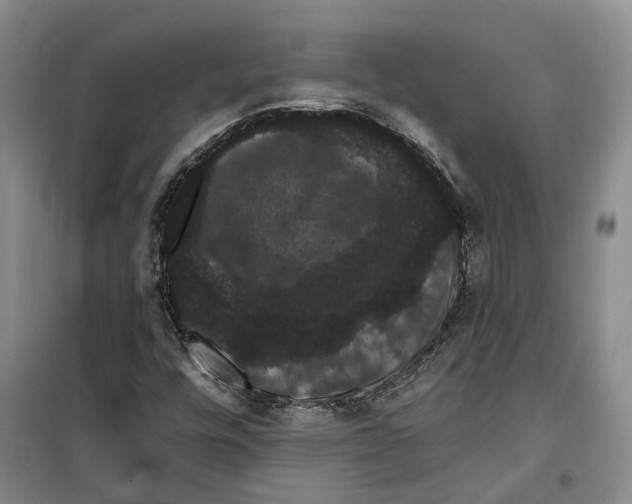X0000099381448200806051110
