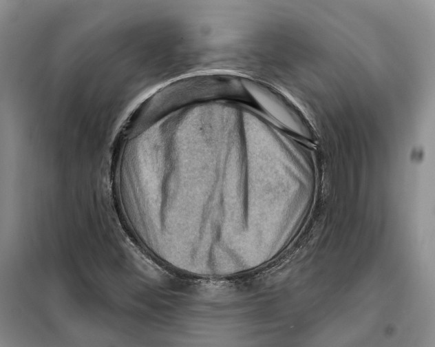 X0000099381452200806051110