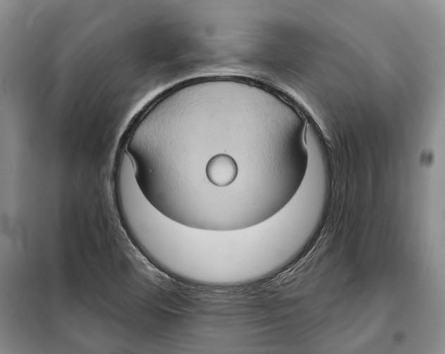 X0000099381460200806051110