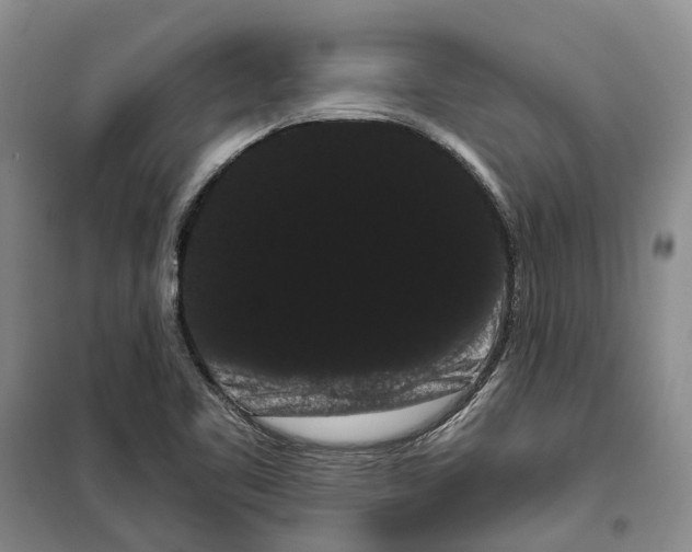 X0000099381461200806051110