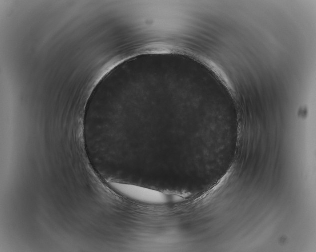 X0000099381465200806051110