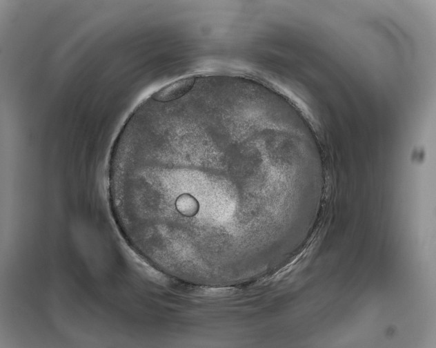 X0000099381471200806051109