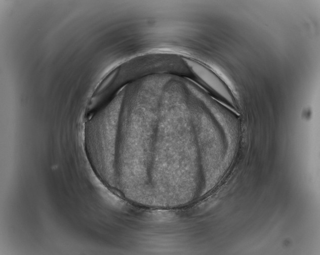 X0000099381476200806051109