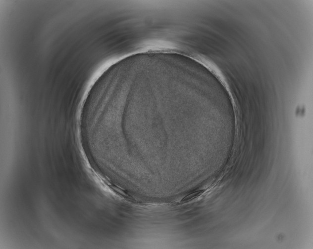 X0000099381488200806051109